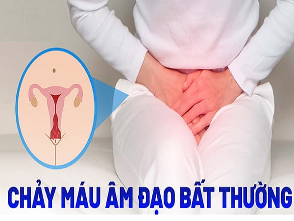 Chảy máu âm đạo bất thường là dấu hiệu ung thư cổ tử cung